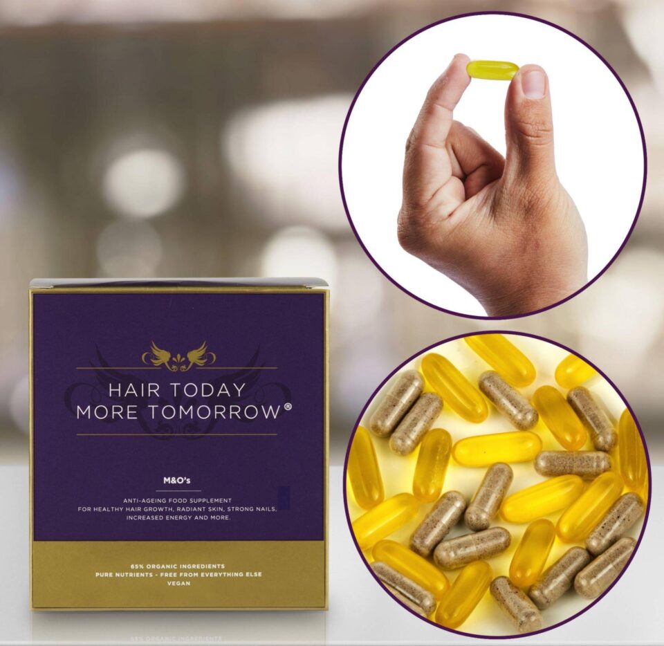 M&O's - Hair Growth Supplement