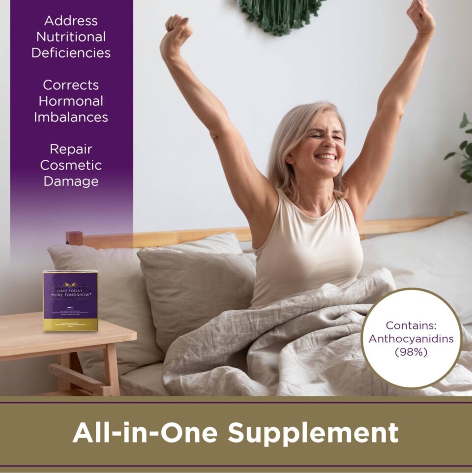 M&O's - Hair Growth Supplement